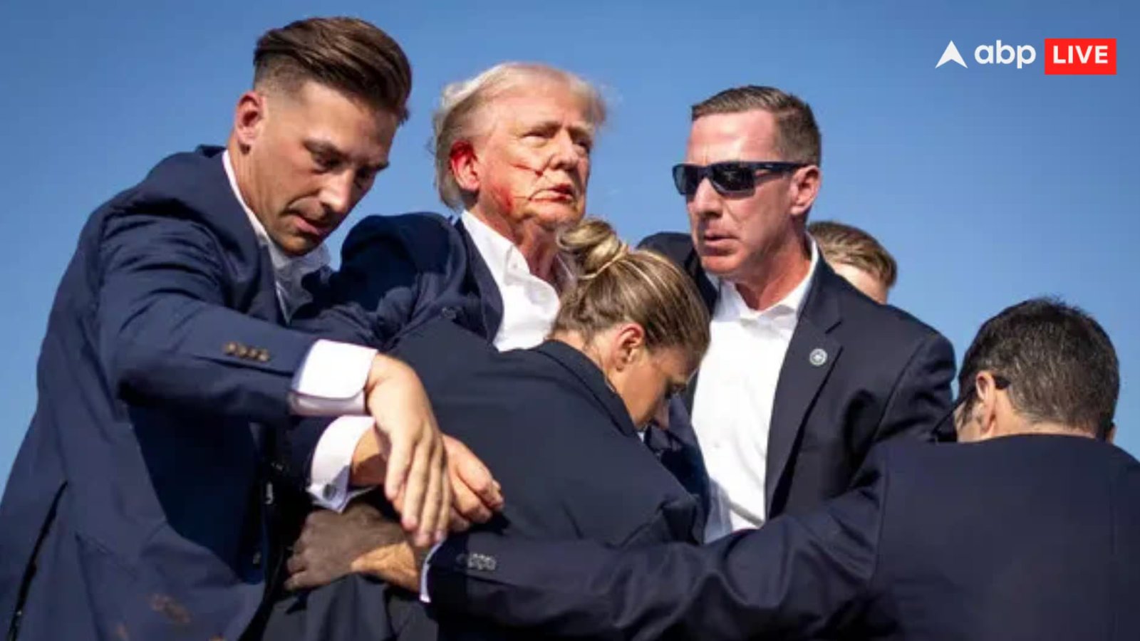 जुलाई 2024 में हुए हमले में ट्रंप का कान घायल हो गया था