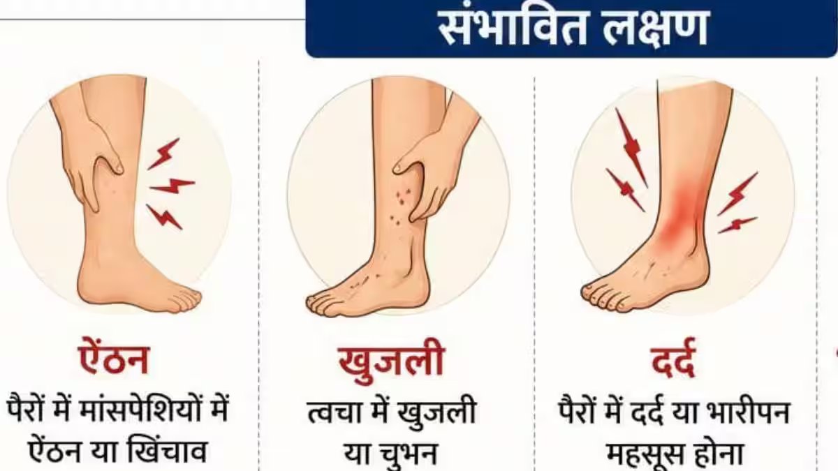 Spider Veins: आपके पापा के पैर में दिख रहे मकड़ी जैसे जाले, कितनी गंभीर है यह समस्या?