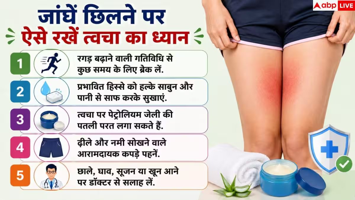 How To Prevent Chafing: जांघे छिलने से हैं परेशान? इन तरीकों से जिंदगी भर के लिए मिल जाएगा आराम